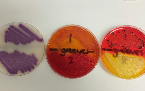 Salmonella in Game Birds